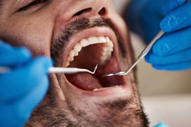 Best Emergency Dental Services for Seniors in Pennside, PA