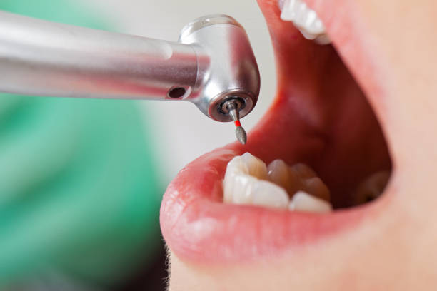 Best Mobile Emergency Dentist in Pennside, PA